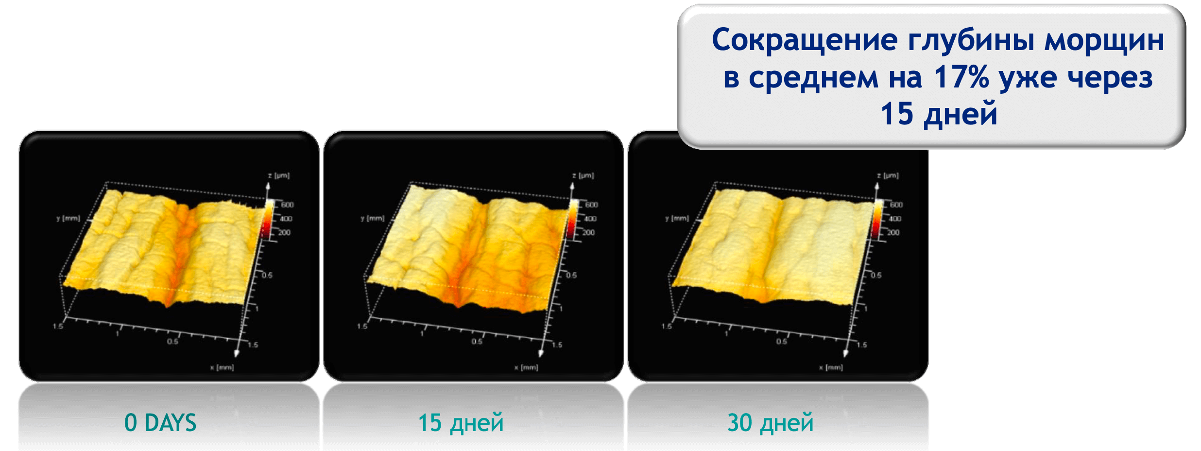 Сокращение морщин от применения Аргирелина